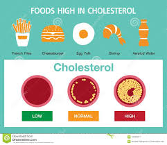 Cholesterol In Artery Health Risk Stock Illustration