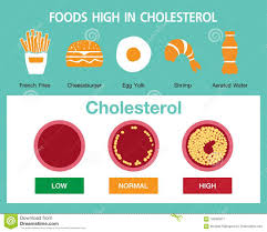 cholesterol in artery health risk stock illustration