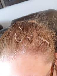 Help I Have Horrible Baby Hairs Fly Aways That Curl When Exposed To Sweat Humidity Despite Pins Hairspray It Make Fly Away Hair Baby Hairstyles Hair Flying