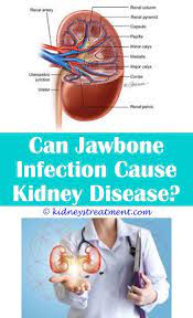 Kidney Disease Drinks Kidney Disease Polycystic Kidney Disease Kidney Disease Symptoms