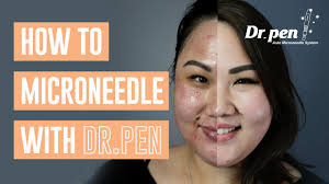 Acids are your new best friend. Best At Home Microneedling Pen Dermapen Reviews 2021
