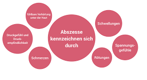 Abszess Hausmittel Abszess Offnen Abszesswunde Pflegen Medica Apotheke Kiel
