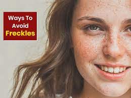 Freckles Prevention Tips: Here's How You Can Prevent These Beauty Spots - Freckles  Prevention Tips: Here's How You Can Prevent These Beauty Spots