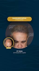 Mais Cabello Prime (@maiscabello.prime) • Instagram photos and videos