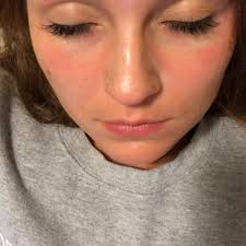 TOP 10 BEST Teeth Whitening in Kettering, OH