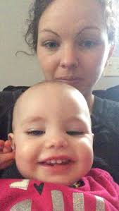 Embracing hair loss with confidence