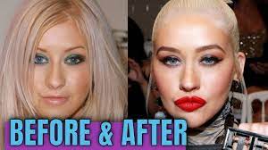 Rumors about plastic surgery had been swirling for a while, yet fans were still shocked to see gwen stefani's face at the grammy awards in . Gwen Stefani Plastic Surgery Major Transformation Youtube