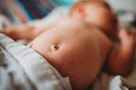 Cosmetic Belly Button Surgery | Allure