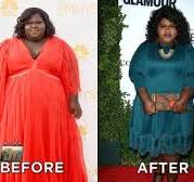 Gabourey Sidibe Reveals Weight Loss Surgery