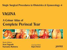 Check spelling or type a new query. A Colour Atlas Of Complete Perineal Tear Volume 4 A C A Of Complete Perineal Tear Sspo G English Edition Ebook Nagrath Arun Malhotra Narendra Rawat Rajani Amazon De Kindle Shop