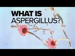 Aspergillus (/ˌæspərˈdʒɪləs/) is a genus consisting of a few hundred mould species found in various climates worldwide. What Is Aspergillus Mold Youtube