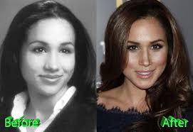 It's about fashion, yes, but it's about. Meghan Markle Ungeschminkt Pin By Bron On Diana S Harry Pre Engagement Meghan Markle Hair Princess Meghan Prince Harry And Megan Il Existe Comme Une Fracture Entre Meghan Markle Et