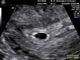 Check spelling or type a new query. Pin On My 3rd Pregnancy 16 Years Later