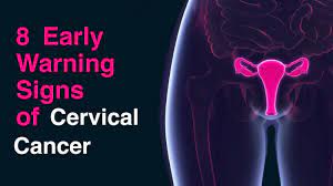 Early on, cervical cancer may not cause signs and symptoms. 8 Early Warning Signs Of Cervical Cancer