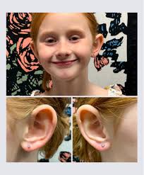 Ear piercing for 6 year old without gun?