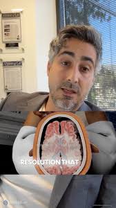 Traumatic brain injuries aren’t always visible—but their impact is  life-changing. When the scans are clean but the symptoms are real, you need  more than words., 🎬 MotionLit creates powerful visuals ...