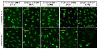 Simultaneous Distinction Of Monospecific And Mixed Dfs70 Patterns During Ana Screening With A Novel Hep 2 Elite Dfs70 Knockout Substrate Protocol Translated To German