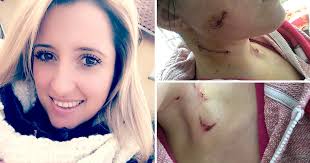 Woman stabbed 11 times would have died without £5 Primark scarf