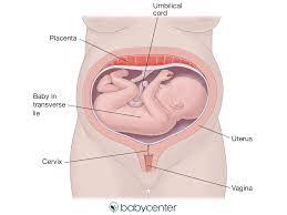 Fetal Presentation Breech Posterior Transverse Lie And More Babycenter
