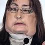 Profile Picture of Family lifts veil on identity of first US face transplant donor - Daily Mailon Google