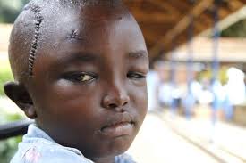 We prayed for Ashim last week in Brandon, MS. He was discharged after  recovering from a successful brain tumor operation! CURE International