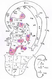 Auricular Therapy For Insomnia