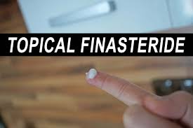 The new hair that you get will even remain for up to 12 months after taking propecia. How To Get Topical Finasteride Without Prescription For Blocking Scalp Dht