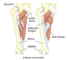 If you know where muscles attach and how. Groin Strain Adductor Strain In Depth Hernia Groin