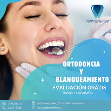 Tu que esperas para reservar tu hora ?