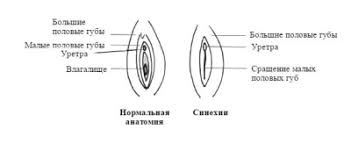 Check spelling or type a new query. Tratamentul Cu Sinechia Komarovsky Sinegia In Fete CauzeazÄƒ Semne È™i Tratament In Moduri Diferite Sinegia In Fete Tratament Cu Vierme