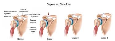 Hold the stretch for 30 seconds. 10 Tips To Get Relief From Shoulder Pain