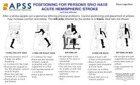 Stroke Patient Positioning Poster Eft Side Affects