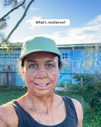 Turia Pitt