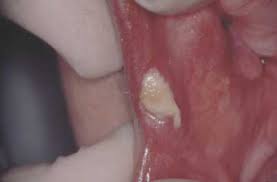 Derfor er det viktig hvilken behandler man velger og at man kan regne med at behandler og et tverrfaglig team. Sar I Munden Tandogmund Dk