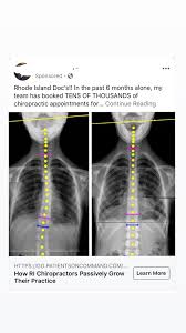 Jul 19, 2008 · with adobe photoshop on your computer, it's super easy to change or adjust the skin tone of somebody in a digital photo. Repost With Name Redacted Did This Chiropractor Photoshop These X Rays Together To Make It Look Like He Cured Scoliosis Or Am I Tripping Residency