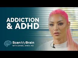 4 Shoulder Exercises You Should Be Doing