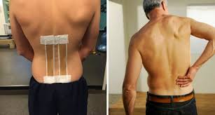 Unfortunately, injuring your spinal discs can be a painful and confusing experience. Bila Sakit Belakang Bukan Semuanya Slipped Disc Maskulin