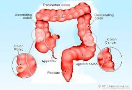 A colon is also used when direct speech is introduced by a name. Colon Cancer Treatment Symptoms Prevention Survival Rate