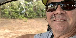 Gruesome fish hook accident