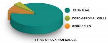 Cancer starts when cells in the body begin to grow out of control. Ovarian Cancer Physiopedia