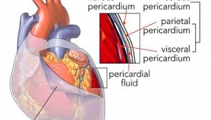 La pericardite acuta rappresenta il 5% delle visite al pronto soccorso per il dolore toracico in assenza di infarto miocardico1. Pericardite Fulminante E Cronica Ecg Cura Contagio Medicina Online