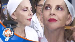 Shanik Berman se somete a intervenciones estéticas en su cuello