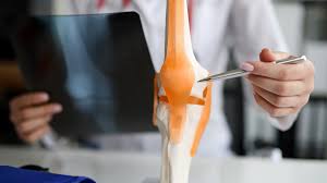 Image result for Hand Growth Plates