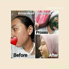 Add water, the ratio is 1 part powder to 1 part water but directions suggest experimenting to find your ideal mask thickness. Spirulina Mojokerto Home Facebook