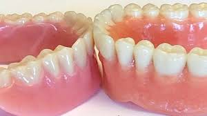 How long does it take to make dentures after impressions. Denture Appointments What To Expect Cranford Dental