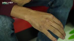 Sau khi cứu cháu bé 2 tuổi rơi từ tầng 12 xuống, anh mạnh được cư dân mạng khen ngợi gọi là người hùng. 1g5qwau5tmmc7m