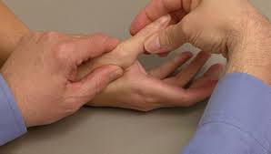 Sprained Thumb - Orthoinfo - Aaos