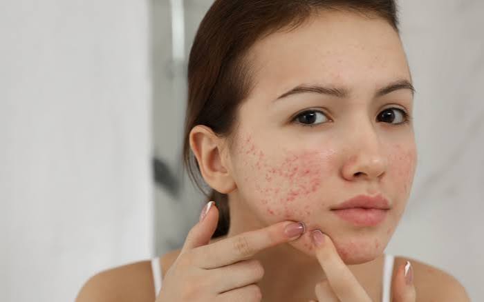 Spot Treatments