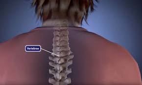 Spinal fusion surgery cost in india. Scoliosis Surgery Things To Consider Orthoinfo Aaos