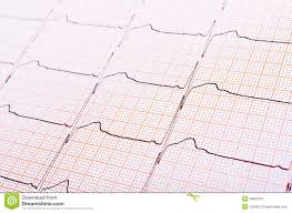 Heart Rhythm Chart Stock Image Image Of Healthcare